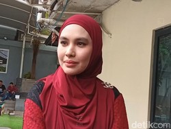 Kartika Putri Tampil Pede Tanpa Filter usai Kena Stevens-Johnson Syndrome