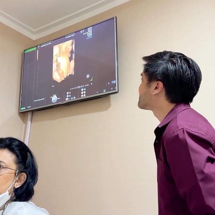 <p>Kevin pun seakan terkesima melihat calon anaknya melalui USG. "Terima kasih untuk support Vicy dan saya selama ini. Ini sangat berarti bagi kami dan semoga kami bisa menjadi orang tua yang baik," tambah Kevin.  Foto: Instagram@kevinaprilio</p>