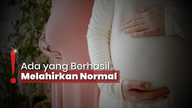 Sederet Selebriti Ini Hamil di Usia 40 Tahun, Apa Kata Dokter Kandungan?