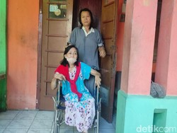 Kisah Pilu Purwaningsih Korban Tragedi Lumpur Lapindo yang Kehilangan Kaki