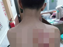Santri Ponpes di Bandar Lampung Dianiaya Senior Pakai Selang