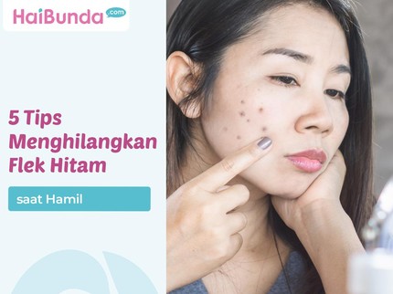 5 Tips Menghilangkan Flek Hitam saat Hamil