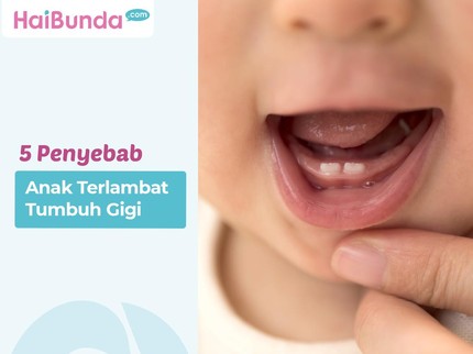5 Penyebab Anak Terlambat Tumbuh Gigi