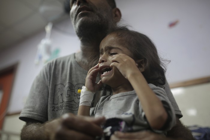 Abdulrahman Al-Rai holds his daughter, Hana Al-Rai, 3, who suffers from diabetes, a weakened immune system, and malnutrition,  as she gets help from her sister to test her blood sugar at Al-Aqsa Martyrs Hospital in Deir al-Balah in the central Gaza Strip, where she is receiving treatment, Saturday, June 1, 2024. The family is displaced from the northern Gaza Strip. (AP Photo/Jehad Alshrafi)