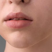 Atasi Bibir Kering dan Pecah-Pecah dengan 3 Bahan Alami Ini, Worth It untuk Dicoba!