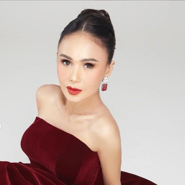 Terungkap Alasan Yuni Shara Belum Mau Operasi Plastik Meski Lagi Tren