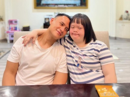 5 Potret Choky Sitohang Dampingi Adik Down Syndrome Ultah ke-29, Tuliskan Ucapan Haru