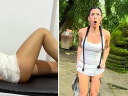 Digigit Monyet Saat Liburan di Bali, Turis Australia Suntik Rabies Rp 97 Juta