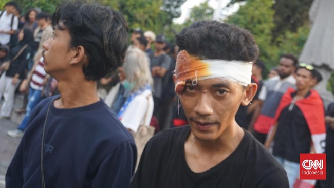 Pelipis Tomi pecah hingga mengeluarkan darah akibat dipukuli saat ikut unjuk rasa menolak program Tapera di Kantor DPRD DIY, Yogyakarta.