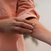Kasus Infeksi Jamur Menular Seksual Pertama Ditemukan di Amerika Serikat, Simak Fakta-faktanya