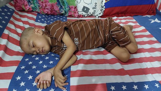 Tanpa Orangtua, Bocah Tak Dapat Bicara dan Berjalan Ini Berjuang dalam Asuhan Nenek