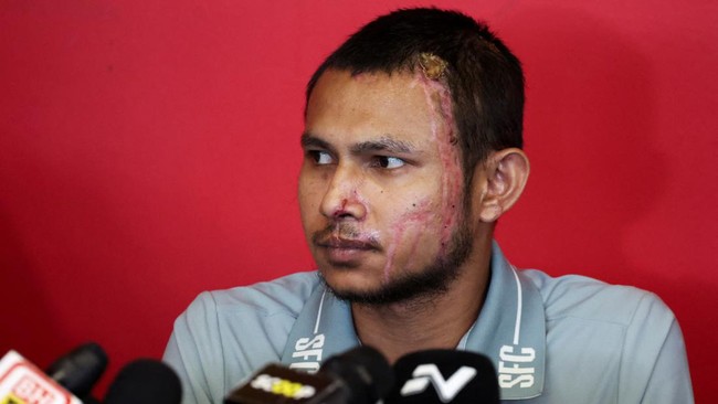 Mantan perdana menteri Malaysia Mahathir Mohamad meminta pihak yang berwenang mencari dalang penyerangan air keras kepada bintang timnas Malaysia, Faisal Halim.