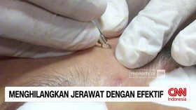 VIDEO: Menghilangkan Jerawat dengan Efektif