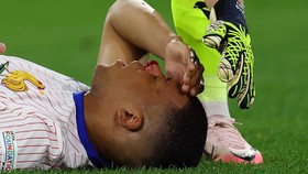 Kronologi Mbappe Patah Hidung hingga Berlumuran Darah