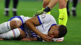 Reaksi Pelatih Prancis Usai Mbappe Berlumuran Darah di Euro 2024