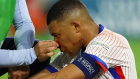 Mbappe Tanya Ide Masker ke Netizen Usai Cedera Horor di Euro 2024