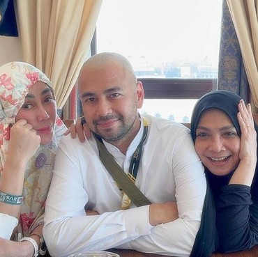 Raffi Ahmad Pamer Kepala Gundul Usai Dibandingkan dengan Fadil Jaidi