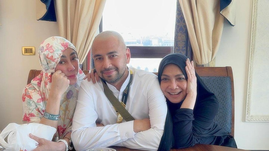 Raffi Ahmad Pamer Kepala Gundul Usai Dibandingkan dengan Fadil Jaidi