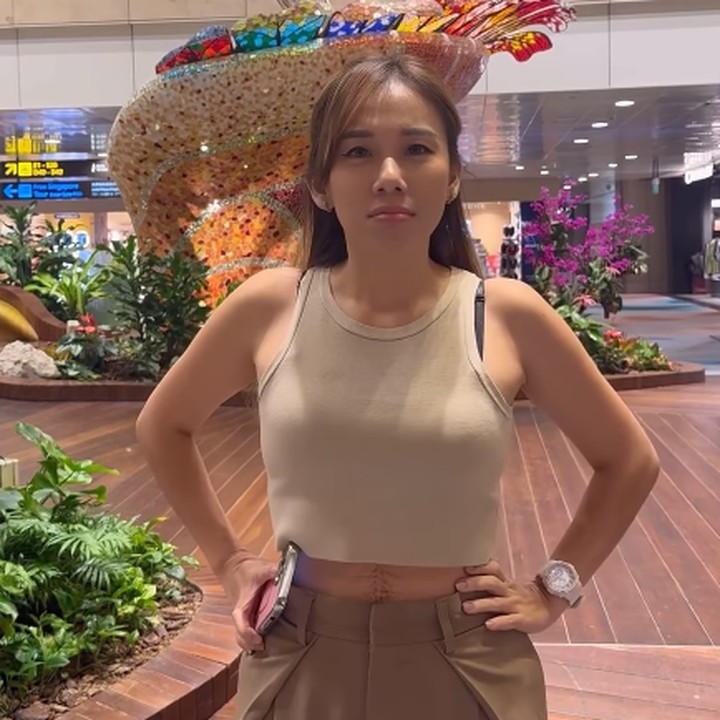 <p>"Dari zaman gadis, perut rata, dan kencang. Begitu hamil, dari berat cuma 45 kilogram naik BB nya sampai ke berat 85 kilogram, tentu perat besar sekali. Akhirnya berhasil turun lagi ke berat ideal tapi menyisakan kulit yang bergelambir atau <em>excess skin</em>," tuturnya dalam sebuah video di Instagram. (Foto: Instagram: @cherly7uno)</p>