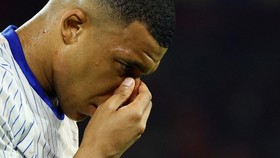 VIDEO: Patah Tulang Hidung, Mbappe Terancam Absen Lawan Belanda