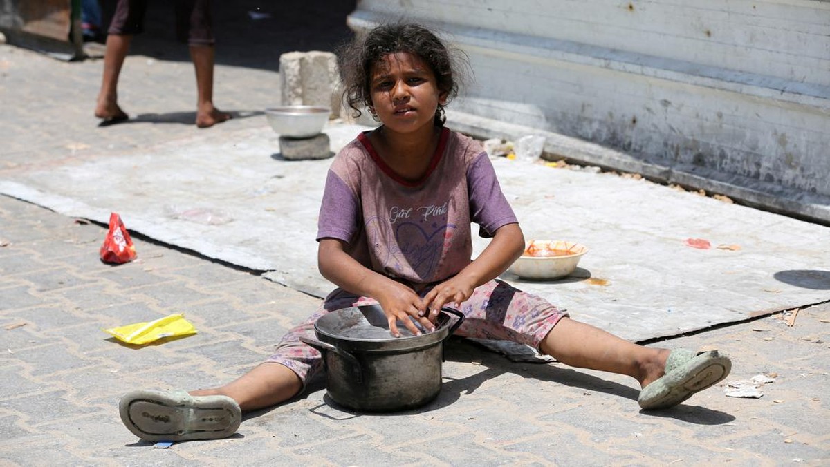 FOTO: 3.500 Anak Palestina Malnutrisi Imbas Agresi Israel di Gaza