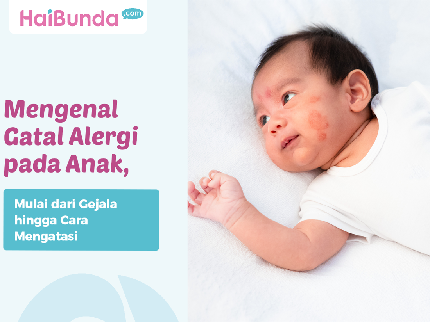 Mengenal Gatal Alergi pada Anak, Mulai dari Gejala hingga Cara Mengatasi