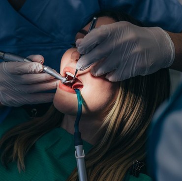 Mau Scaling Gigi Gratis Pakai BPJS? Ini Fakta Sebenarnya yang Sering Bikin Salah Paham!