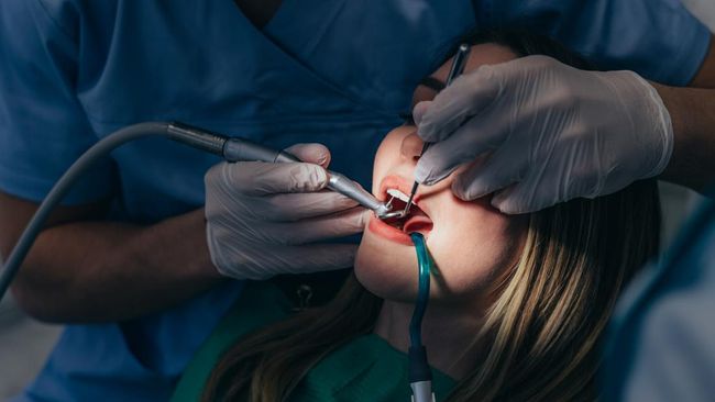 Mau Scaling Gigi Gratis Pakai BPJS? Ini Fakta Sebenarnya yang Sering Bikin Salah Paham!