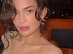 Terinspirasi dari Kylie Jenner, Tren Filler Agar Wajah Tampak Tak Senyum
