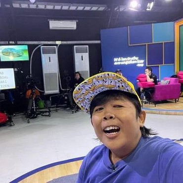 Adul Ungkap Pernah Cedera hingga Masuk Rumah Sakit Akibat Berkomedi