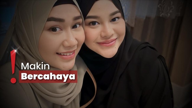 Wajah Aurel Hermansyah Jadi Perhatian Usai Pulang Ibadah Haji