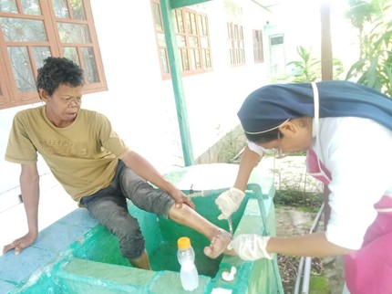 Tragisnya Kehidupan Penderita Kusta di Sumba, Tak Bisa Bekerja hingga Dikucilkan