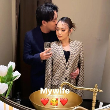 Tak Hanya Mahalini, Rizky Febian Diduga Ikutan Istri Oplas gegara Hal Ini