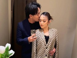 Tak Hanya Mahalini, Rizky Febian Diduga Ikutan Istri Oplas gegara Hal Ini