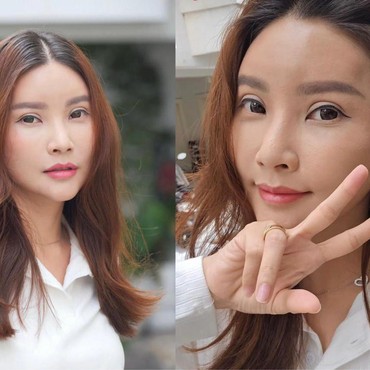 Penampilan Terbaru Sarwendah Hasil Operasi Plastik di Korea