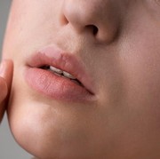 6 Cara Mudah Merawat Bibir yang Pecah-Pecah