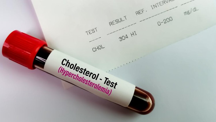 Hiperkolesterolemia