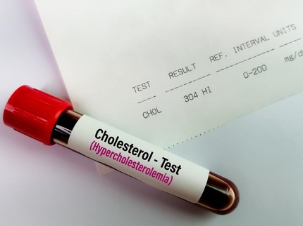 Mengenal Hiperkolesterolemia, Kondisi Kolesterol Meningkat Signifikan yang Berbahaya