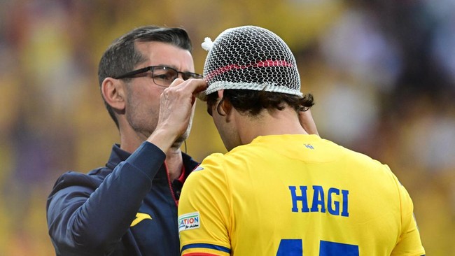 Di laga 16 besar Euro 2024 antara Rumania vs Belanda, Ianis Hagi mengalami benturan kepala sehingga terpaksa mengenakan jaring rambut untuk menekan pendarahan.