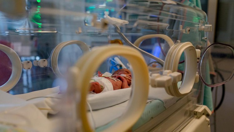Anencephaly Anencephaly
