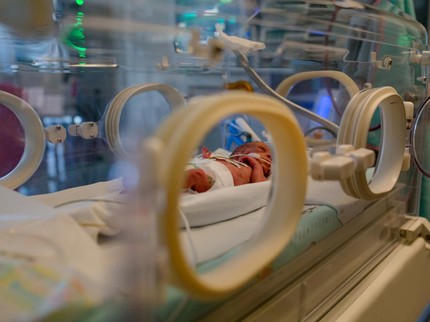 5 Fakta Anencephaly, Bayi Lahir Tanpa Tempurung Kepala Utuh