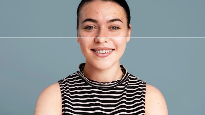 img-title Jangan Asal Pakai, Ini 6 Perubahan Kulit Wajah Tanda Tak Cocok dengan Produk Skincare