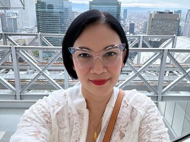 img-title Operasi Plastik di Usia 53 Tahun, Dian Nitami: Ngeri-ngeri Sedep
