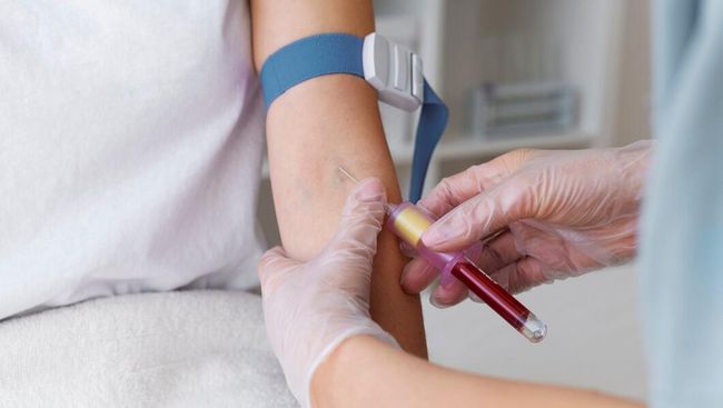 Perlu Diperhatikan, 5 Orang dengan Kondisi Ini Tidak Boleh Mendonorkan Darah