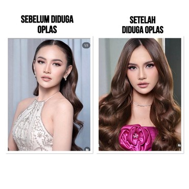 Foto Mahalini Pamer Mata Sembab gegara Nangis Disorot, Diduga Oplas Eyelid