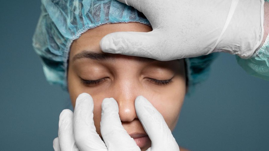 Rhinoplasty Rhinoplasty