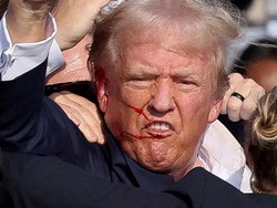 Trump: Saya Ditembak dengan Peluru Menembus Bagian Atas Telinga Kananku