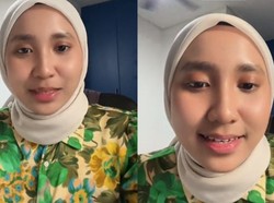 Viral Wanita Tertular Herpes gegara Mencoba Tester Lipstik