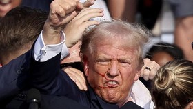 Selamat dari Penembakan, Trump Tegaskan Ikut Konvensi Partai Republik