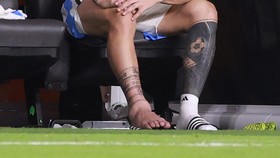 Reaksi Netizen Lihat Ankle Messi Bengkak: Bakso Ditaruh di Kaki